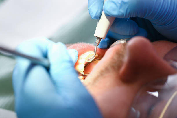Best Emergency Denture Repair in La Crosse, KS
