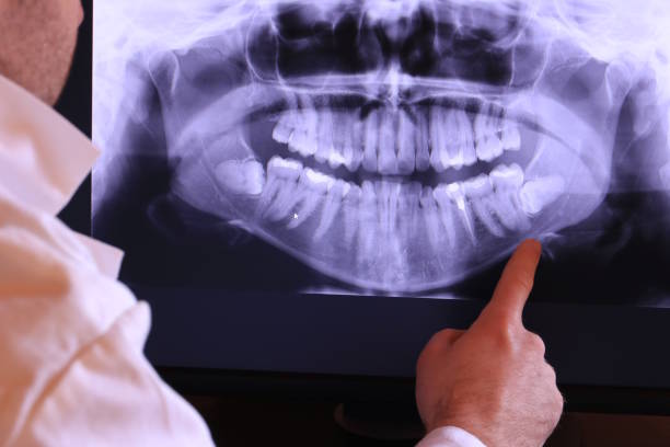 Best Cosmetic Emergency Dentistry in La Crosse, KS