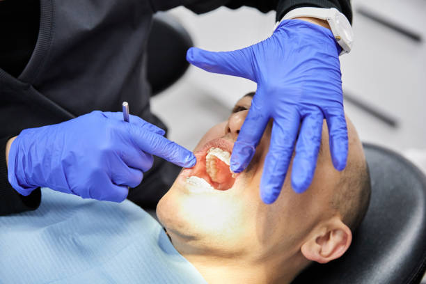Best Urgent Care for Lost Fillings or Crowns in La Crosse, KS